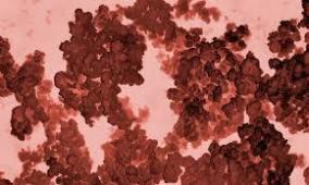 Laboratorio Chileno crea Desinfectante con nanopartículas de Cobre para atacar el Covid-19